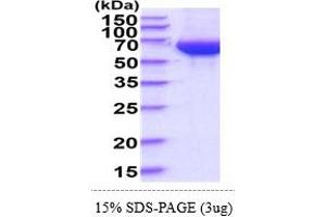 SDS-PAGE (SDS) image for Udp-N-Acetyl-alpha-D-Galactosamine:polypeptide N-Acetylgalactosaminyltransferase 1 (GalNAc-T1) (Galnt1) (AA 41-559) protein (His tag) (ABIN6388150)