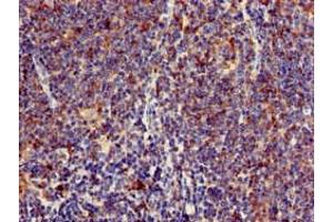 Immunohistochemistry of paraffin-embedded human lymph node tissue using ABIN7158646 at dilution of 1:100 (BC055111 anticorps  (AA 1-418))