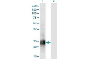 Western Blot analysis of MID1IP1 expression in transfected 293T cell line by MID1IP1 monoclonal antibody (M01), clone 8G8. (m1ip1 anticorps  (AA 1-183))