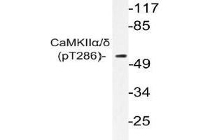 Western blot (WB) analyzes of p-CaMKIIalpha/delta antibody in extracts from K562 cells. (CAMK2A anticorps  (pThr286))