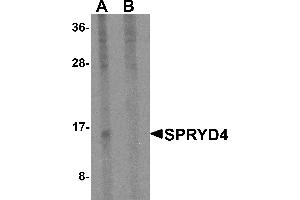 Western blot analysis of SPRYD4 in mouse kidney tissue lysate with SPRYD4 antibody at 1 µg/mL in (A) the absence and (B) the presence of blocking peptide (SPRYD4 anticorps  (Middle Region))