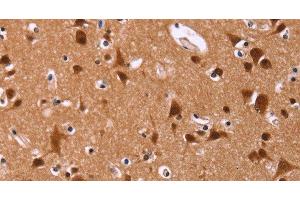 Immunohistochemistry of paraffin-embedded Human brain tissue using ART5 Polyclonal Antibody at dilution 1:50 (ART5 anticorps)