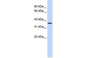 WB Suggested Anti-C8orf70 Antibody Titration:  0. (FAM164A anticorps  (Middle Region))