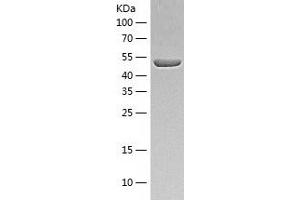 Western Blotting (WB) image for Alanine Aminotransferase (ALT) (AA 1-496) protein (His-IF2DI Tag) (ABIN7121760)