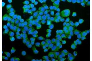 anti-Prolyl 4-Hydroxylase, beta Polypeptide (P4HB) (AA 146-363) antibody