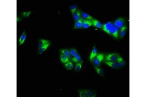 Immunofluorescence staining of Hela cells with ABIN7157894 at 1:66, counter-stained with DAPI. (Laminin gamma 1 anticorps  (AA 1333-1607))