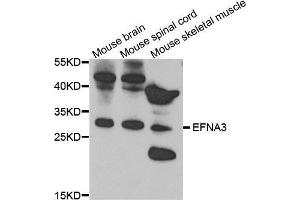 Western Blotting (WB) image for anti-Ephrin A3 (EFNA3) (AA 23-214) antibody (ABIN3016534) (Ephrin A3 anticorps  (AA 23-214))