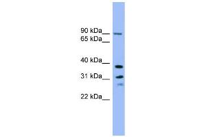 WB Suggested Anti-LHPP Antibody Titration: 0. (LHPP anticorps  (Middle Region))