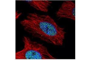 ICC/IF Image Confocal immunofluorescence analysis (Olympus FV10i) of paraformaldehyde-fixed HeLa, using alpha Actinin 4, antibody (Green) at 1:500 dilution.