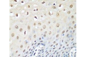 Immunohistochemistry of paraffin-embedded Human esophagus using VCP Polyclonal Antibody at dilution of 1:200 (40x lens).