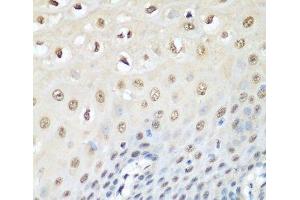 Immunohistochemistry of paraffin-embedded Human esophagus using VCP Polyclonal Antibody at dilution of 1:200 (40x lens). (VCP anticorps)