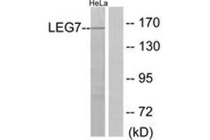 Western blot analysis of extracts from HeLa cells, using LEG7 Antibody. (LGALS7 anticorps  (AA 41-90))