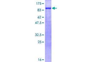 Image no. 1 for Junction Plakoglobin (JUP) (AA 1-745) protein (GST tag) (ABIN1308342)