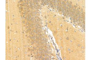 Phospho-EPRS (Ser886) Antibody at 1/100 staining Rat brain tissue by IHC-P. (EPRS anticorps  (pSer886))