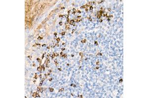 Immunohistochemistry of paraffin-embedded Human tonsil using Human IgG antibody (ABIN7267844) at dilution of 1:300 (40x lens).