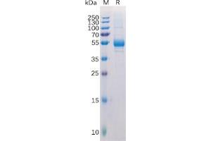 Human TNFSF11 Protein, hFc Tag on SDS-PAGE under reducing condition. (RANKL Protein (Fc Tag))