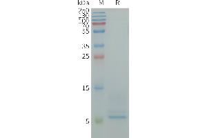Human CD9 Protein, His Tag on SDS-PAGE under reducing condition.