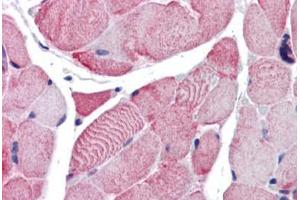 Human Skeletal Muscle (formalin-fixed, paraffin-embedded) stained with ACTB antibody ABIN337375 at 10 ug/ml followed by biotinylated goat anti-rabbit IgG secondary antibody ABIN481713, alkaline phosphatase-streptavidin and chromogen. (beta Actin anticorps  (C-Term))