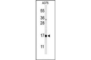 Western blot analysis of DAZAP2 Antibody (C-term) in A375 cell line lysates (35ug/lane). (DAZAP2 anticorps  (C-Term))