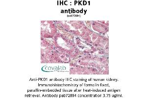 Image no. 2 for anti-Polycystic Kidney Disease 1 (Autosomal Dominant) (PKD1) (C-Term) antibody (ABIN1738122) (PKD1 anticorps  (C-Term))
