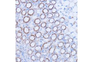 Immunohistochemistry of paraffin-embedded mouse kidney using MT-ND1 antibody (ABIN7268598) at dilution of 1:100 (40x lens).