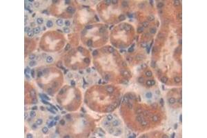 Used in DAB staining on fromalin fixed paraffin- embedded Kidney tissue