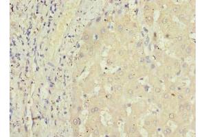 Immunohistochemistry of paraffin-embedded human liver tissue using ABIN7164457 at dilution of 1:100 (GPR146 anticorps  (AA 301-333))