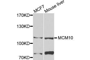Western blot analysis of extracts of MCF7 and mouse liver cells, using MCM10 antibody. (MCM10 anticorps)