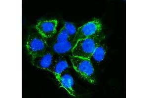 IF analysis of LSR using anti-LSR antibody (ABIN7599514).
