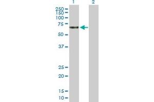 Western Blot analysis of TBCD expression in transfected 293T cell line by TBCD MaxPab polyclonal antibody. (TBCD anticorps  (AA 1-623))