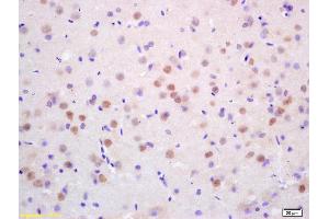 Formalin-fixed and paraffin embedded rat brain labeled with Rabbit Anti CDC10/Septin 7 Polyclonal Antibody, Unconjugated (ABIN873015) at 1:200 followed by conjugation to the secondary antibody and DAB staining (Septin 7 anticorps  (AA 201-300))