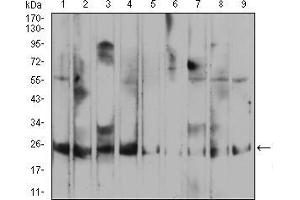Western blot analysis using RALA mouse mAb against HepG2 (1), MCF-7 (2), A549 (3), K562 (4), Raji (5), MOLT4 (6), Hela (7), COS7 (8), and NIH3T3 (9) cell lysate.