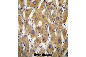 Immunohistochemistry (IHC) image for anti-P Antigen Family, Member 5 (Prostate Associated) (PAGE5) antibody (ABIN2996953) (PAGE5 anticorps)
