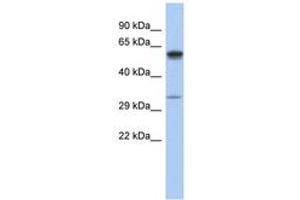 Image no. 1 for anti-Zinc Finger, DHHC-Type Containing 24 (ZDHHC24) (C-Term) antibody (ABIN6743943) (ZDHHC24 anticorps  (C-Term))