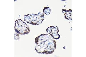 Immunohistochemistry of paraffin-embedded human placenta using RPL23A Rabbit pAb (ABIN1682576, ABIN3018519, ABIN3018520 and ABIN6220494) at dilution of 1:100 (40x lens).