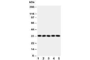 Western blot testing of LOX-1 antibody and Lane 1:  HeLa (OLR1 anticorps  (N-Term))