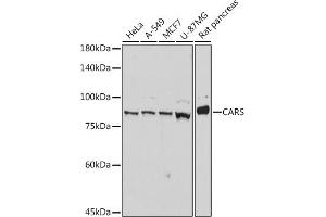 Western blot analysis of extracts of various cell lines, using CARS antibody (ABIN7266624) at 1:1000 dilution. (CARS anticorps)