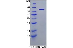 SDS-PAGE (SDS) image for Apolipoprotein A-II (APOA2) (AA 24-100) protein (His tag,GST tag) (ABIN1877597) (APOA2 Protein (AA 24-100) (His tag,GST tag))