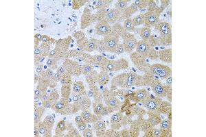 Immunohistochemistry of paraffin-embedded human liver injury using POMGNT1 antibody. (POMGNT1 anticorps)