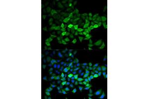 Immunofluorescence analysis of HeLa cells using UBE2C antibody.