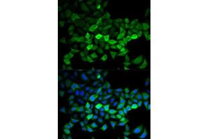 Immunofluorescence analysis of HeLa cells using UBE2C antibody. (UBE2C anticorps  (AA 1-179))