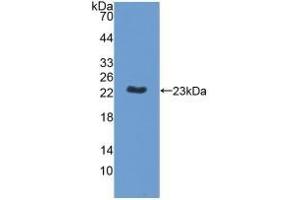 Detection of Recombinant MPP6, Human using Polyclonal Antibody to Membrane Protein, Palmitoylated 6 (MPP6)