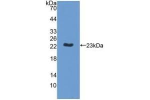 Detection of Recombinant MPP6, Human using Polyclonal Antibody to Membrane Protein, Palmitoylated 6 (MPP6) (MPP6 anticorps  (AA 331-503))