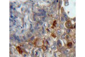 Used in DAB staining on fromalin fixed paraffin-embedded lung tissue (Podoplanin anticorps  (AA 23-143))