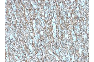 Formalin-fixed, paraffin-embedded human Brain stained with Neurofilament Mouse Recombinant Monoclonal Antibody (rNF421). (Recombinant NEFH anticorps)