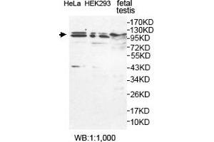 Western blot analysis of feteal testis, HeLa and HEK293 cell lysates, using USP29 antibody. (USP29 anticorps  (AA 15-215))