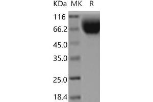 Western Blotting (WB) image for Signal-Regulatory Protein alpha (SIRPA) (Active) protein (His tag) (ABIN7321157)