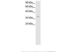 Image no. 2 for anti-Zinc Finger Protein 391 (ZNF391) (AA 66-115) antibody (ABIN6735795) (ZNF391 anticorps  (AA 66-115))