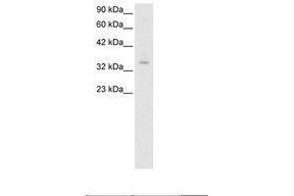 ZNF391 anticorps  (AA 66-115)