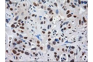 Immunohistochemistry (IHC) image for anti-alpha-Fetoprotein (AFP) (AA 19-397) antibody (ABIN2716008)